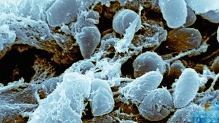 a microscopic image showing cells of the bacterium that causes plague depicted in light blue